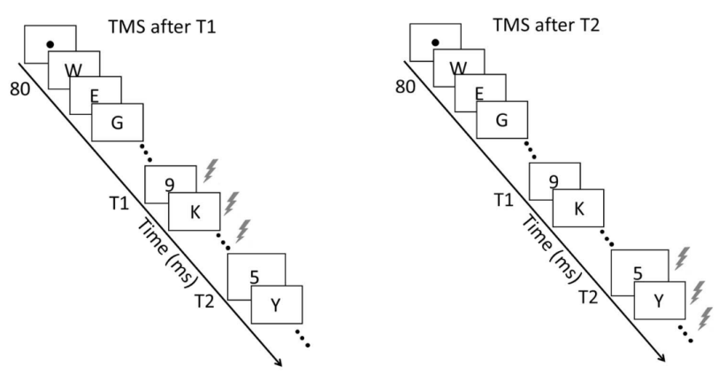 rTMS实验刺激及流程示意图